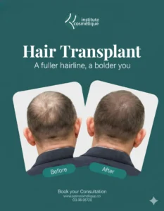 Hair Restoration