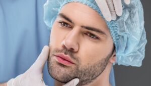 Beard hair transplant treatment for improving patchy beard growth